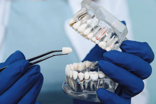 Призначення стоматолога, інструменти стоматології та концепція перевірки гігієни зубів за допомогою зубних моделей зубів та стоматологічних інструментів на темно-сірому. Регулярні перевірки необхідні для здоров'я ротової порожнини — стокове фото