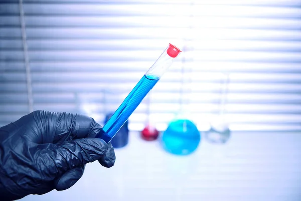 El empleado del laboratorio con guantes médicos negros sostiene un tubo de ensayo con un líquido azul.Virus, epidemia y cuarentena . — Foto de Stock