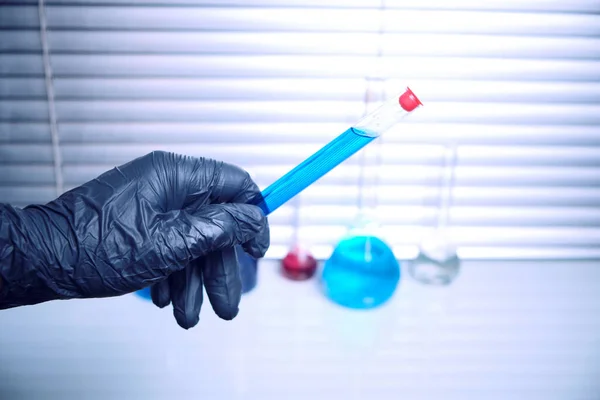 Laboráns fekete orvosi kesztyűben tart egy kémcső kék folyadék.Vírus, járvány, és karantén. — Stock Fotó
