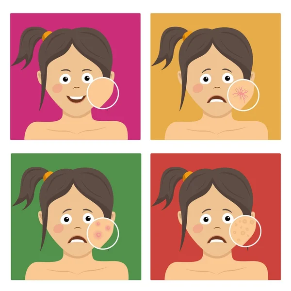 Avatar definido para infográfico de cuidados com a pele. Menina adolescente com problemas de pele facial —  Vetores de Stock