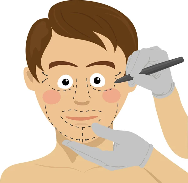 Surgeon drawing marks on male face. Plastic surgery concept — Stock Vector