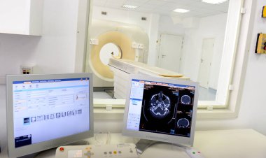 Sofya, Bulgaristan 1 Aralık 2016 üzerinde hastane laboratuarında Mr'ı inceden inceye gözden geçirmek