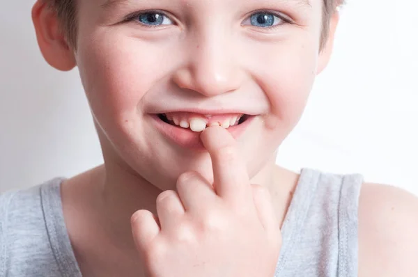 Modrooký Blonďák Zasměje Ukáže První Zub Dětské Zuby Ztráta Prsty — Stock fotografie