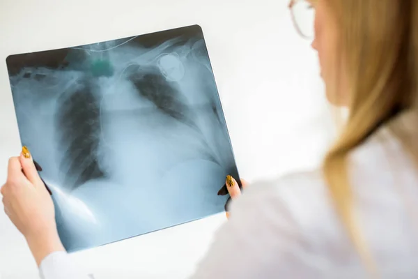 Молодой Доктор Сотрет Снимок Легких Диагноз Пневмонии Туберкулеза Рентгеновское Обследование — стоковое фото