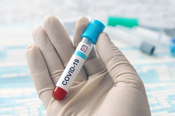 Médico de mano sosteniendo el tubo de prueba con sangre para 2019 - análisis nCoV en laboratorio. Nuevo Coronavirus originario de China. Concepto de análisis de sangre por Coronavirus. Desarrollo de la vacuna contra el virus . — Foto de Stock