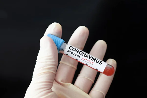 Enfermera que tiene un resultado positivo de la prueba de sangre para el nuevo Coronavirus de rápida propagación, que se origina en China sobre un fondo negro oscuro. letras en la etiqueta coronavirus positivo — Foto de Stock
