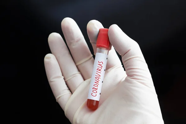 Concepto de análisis de sangre por Coronavirus. Médico mano en guante médico blanco sosteniendo tubo con Coronavirus sangre positiva en laboratorio sobre fondo negro. 2019-nCoV Coronavirus originario de Wuhan, China — Foto de Stock