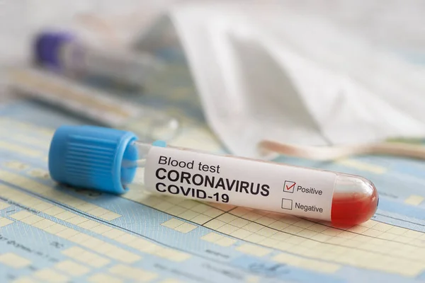 Test tube with blood test is on the table next to the documents and a protective medical mask. Positive test coronavirus covid-19. The concept of fighting a dangerous Chinese disease. COVID-2019 — стокове фото