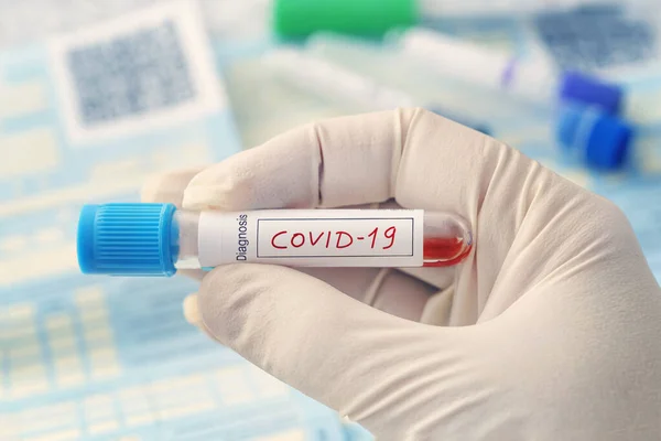 Coronavirus 2019 Ncov Blood Sample Нова Епідемічна Корона Вірус Вибух — стокове фото