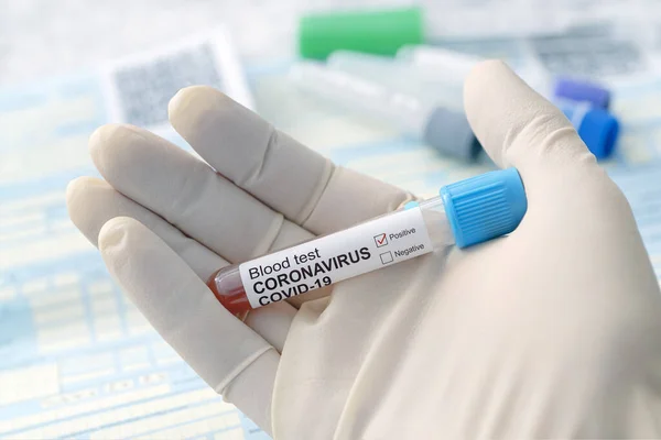 2019 Ncov Coronavirus Originar Din Wuhan China Conceptul Test Sânge — Fotografie, imagine de stoc