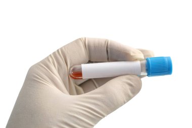Beyaz arka planda boş bir test tüpü olan bir el. Tasarım veya metin için boş etiket. izole arkaplan.