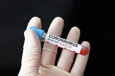Nurse holding negative blood test result for the new rapidly spreading Coronavirus on dark black background. lettering on label coronavirus test. recovered from coronavirus covid 19 clipart