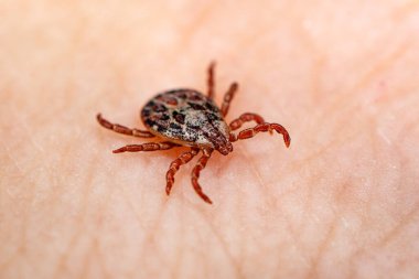 Borrelia Virüslü Tik Böceği Deride Sürünüyor. Ensefalit Virüsü veya Lyme Borrelia Hastalığı Bulaşıcı Dermacentor Tick Arachnid Parazit Macro. Dermacentor retikülatus