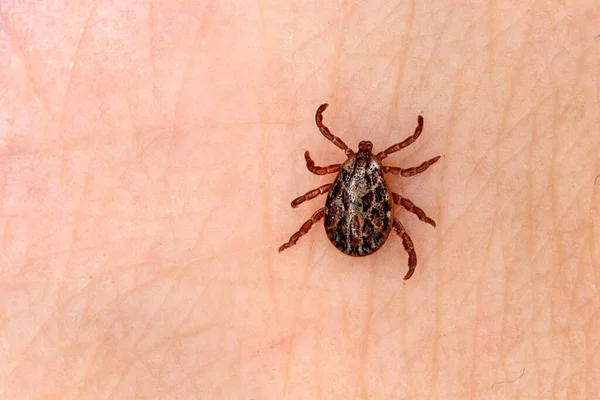 A dangerous blood-sucking insect. small brown spotted mite, biological name Dermacentor marginatus on human skin. Tick on the skin background. macrophoto