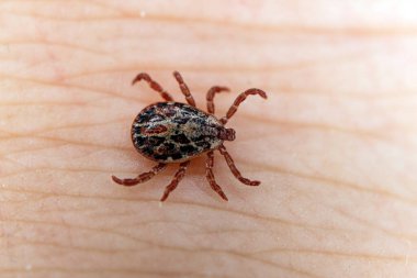 Tehlikeli bir kan emici böcek. Küçük kahverengi benekli mayt, biyolojik adı Dermacentor marginatus insan derisi üzerinde. makro fotoğraf