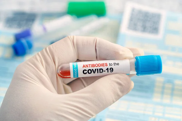 Ensayos Anticuerpos Infección Coronavirus Verificar Inmunidad Población Covid Tubo Prueba — Foto de Stock