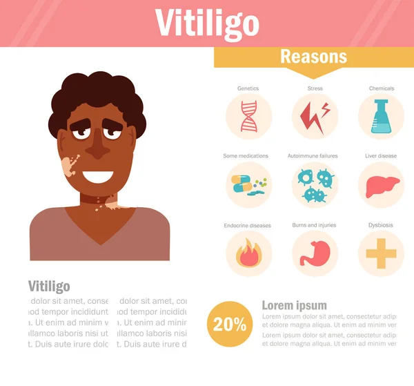 Vitiligo. Pigmentációs zavarok. Elszigetelt — Stock Vector