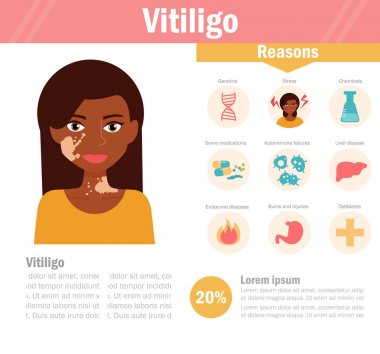 Vitiligo. Pigmentasyon bozukluğu