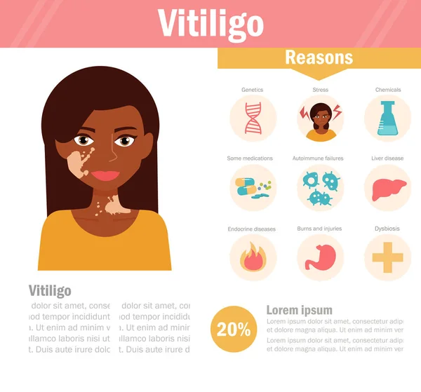 Vitiligo. Tulburare de pigmentare — Vector de stoc