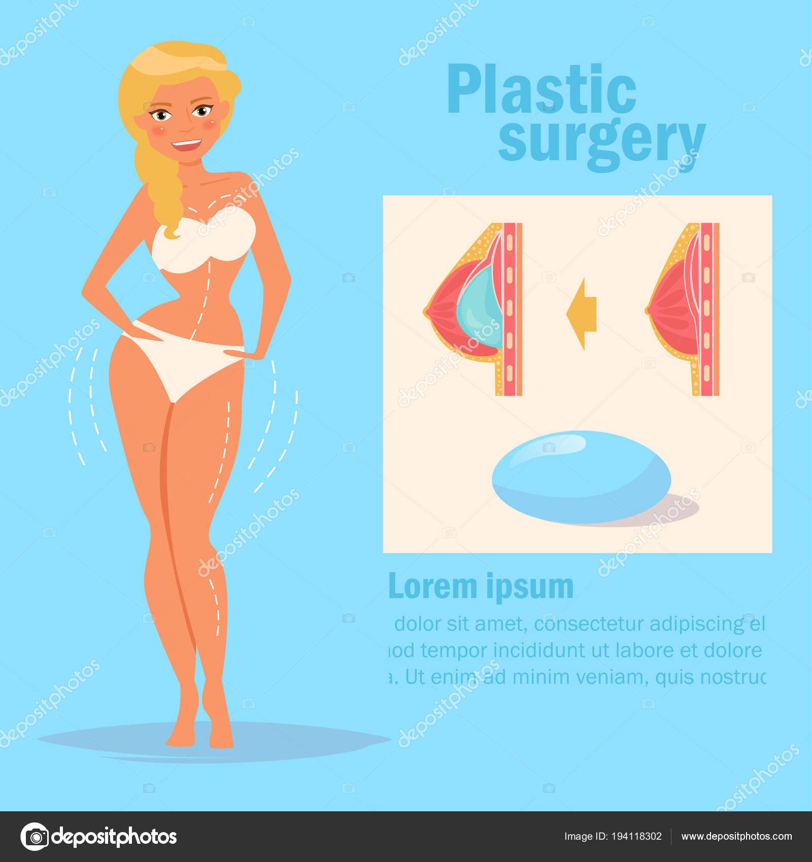 63 Breast implants Stock Illustrations