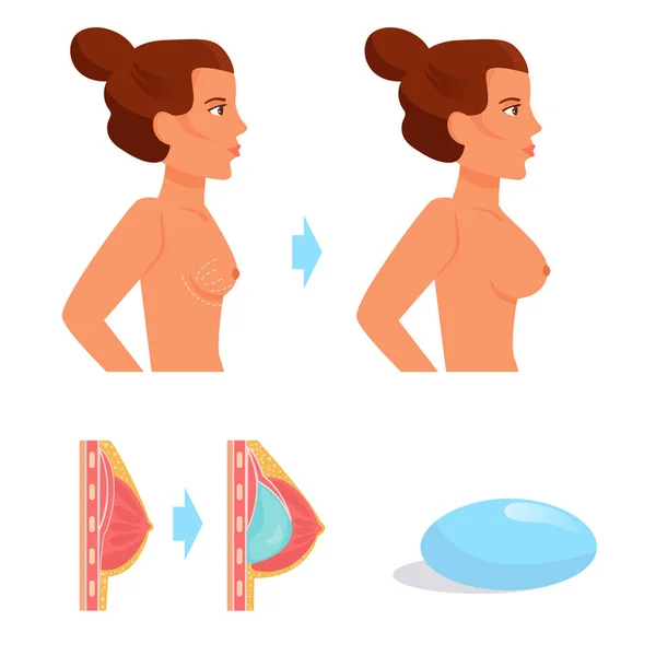 Cirurgia plástica Vector. Desenhos animados — Vetor de Stock