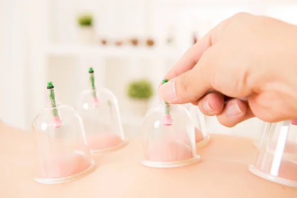 Cupping therapy spa woman removes — Stock Photo, Image