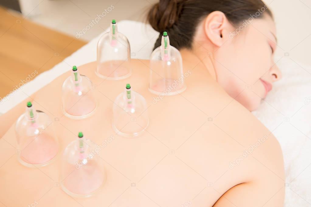 cupping cups on back of asian female
