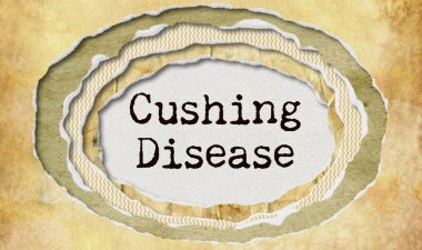 Cushing disease - typewritten word in ragged paper hole background -  Cushing's syndrome - concept tattered illustration clipart
