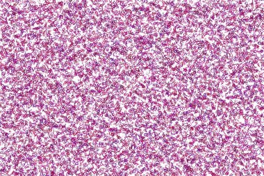 Geniş harfler arkaplanı karıştırır