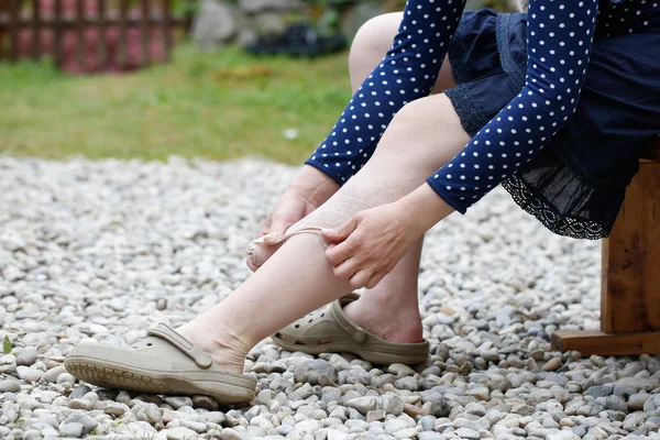 Kvinna med åderbråck tillämpa komprimering bandage — Stockfoto