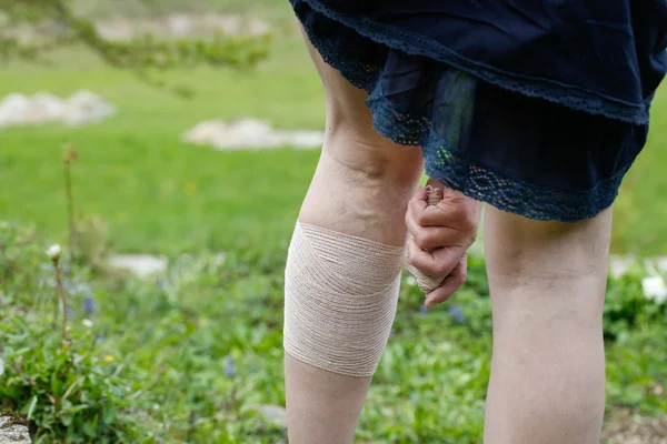 Donna con vene varicose che applica una benda di compressione — Foto Stock