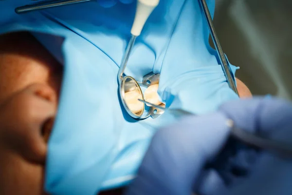 Le patient reçoit un traitement dentaire avec protection de barrage en caoutchouc dentaire — Photo