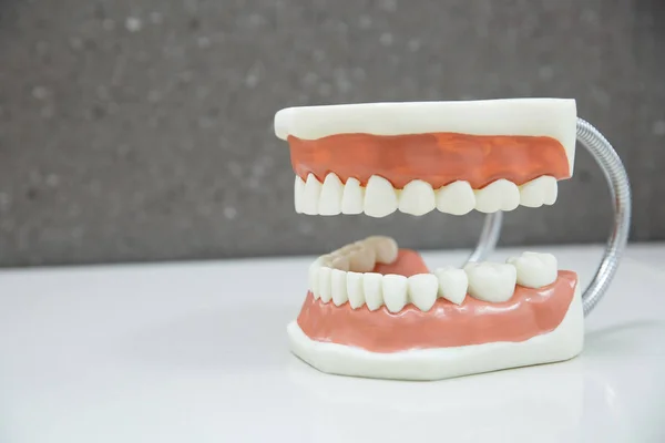 Modelo dentário de mandíbula superior e inferior — Fotografia de Stock