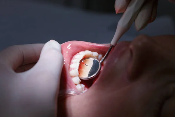 Paciente examinando sus espacios interdentales — Foto de Stock