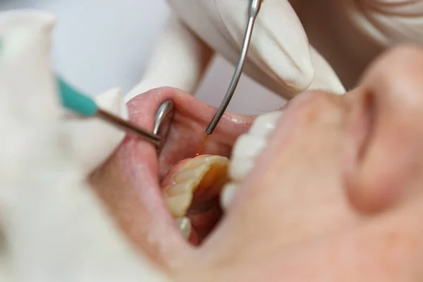 Láser dental utilizado en un paciente — Foto de Stock