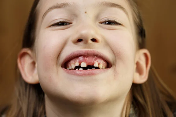 Criança sorrindo, mostrando seus dentes de leite desaparecidos — Fotografia de Stock