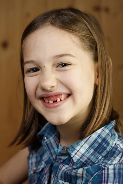 Barnet ler, visar hennes saknade mjölk tänder — Stockfoto