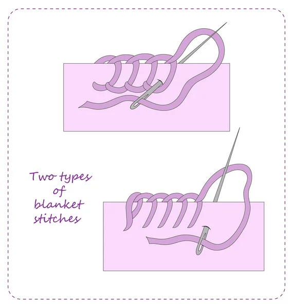 Battaniye dikiş türleri