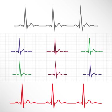 Öğeler ve çizgiler normal EKG