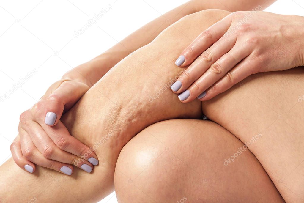 Cellulite and loose skin.