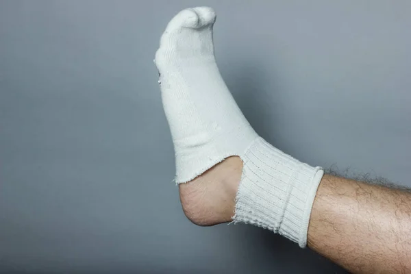 Straight leg with a big hole in the sock — Stock Photo, Image