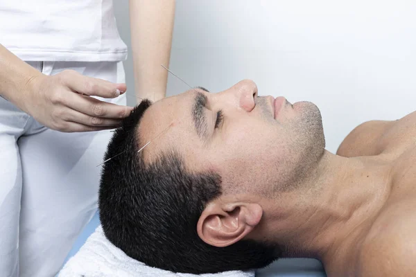 Terapeuta Dopasowujący Igły Akupunkturowe Głowy Człowieka Wleczeniu Pępowiny — Zdjęcie stockowe