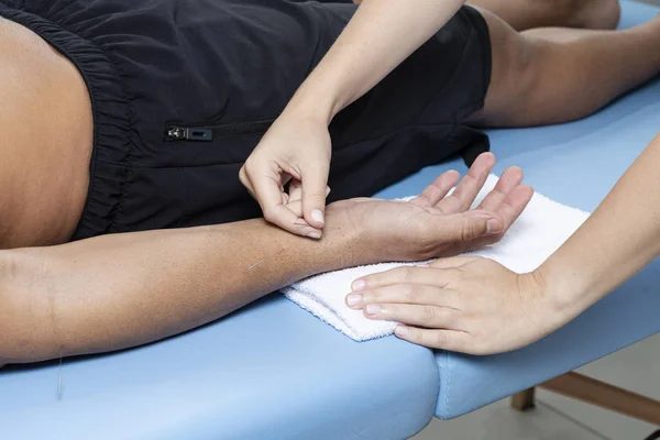 Detalj Terapeut Justera Akupunktur Nålar Man Hand Akultur Behandling — Stockfoto