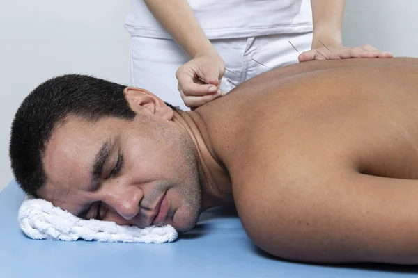 Terapista Regolazione Aghi Agopuntura Sulla Schiena Dell Uomo Trattamento Aculpultura — Foto Stock