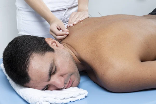 Therapist adjusting acupuncture needles on man back in aculpulture treatment.