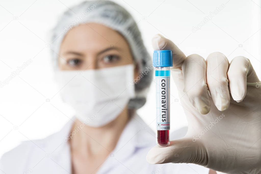 Nurse showing tube with positive result on the coronavirus blood test. Epidemic virus Respiratory Syndrome. China.
