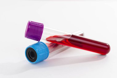 Blood test tube on white background. space for text.
