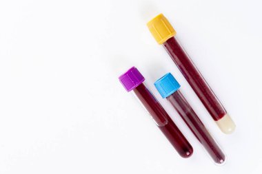 Blood test tube on white background. Top view.