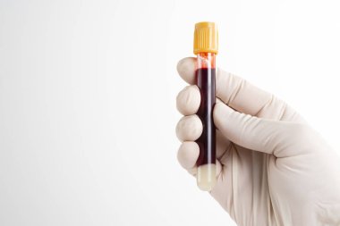 Male nurse presented blood test on white background.
