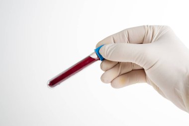Male nurse holding blood test on white background. Space for text.